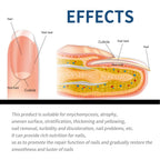 FungalCure™ - Renewal Fungal Nail Patches